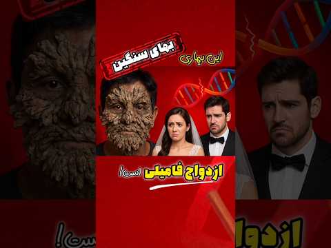 چرا ازدواج فامیلی توصیه نمی شود